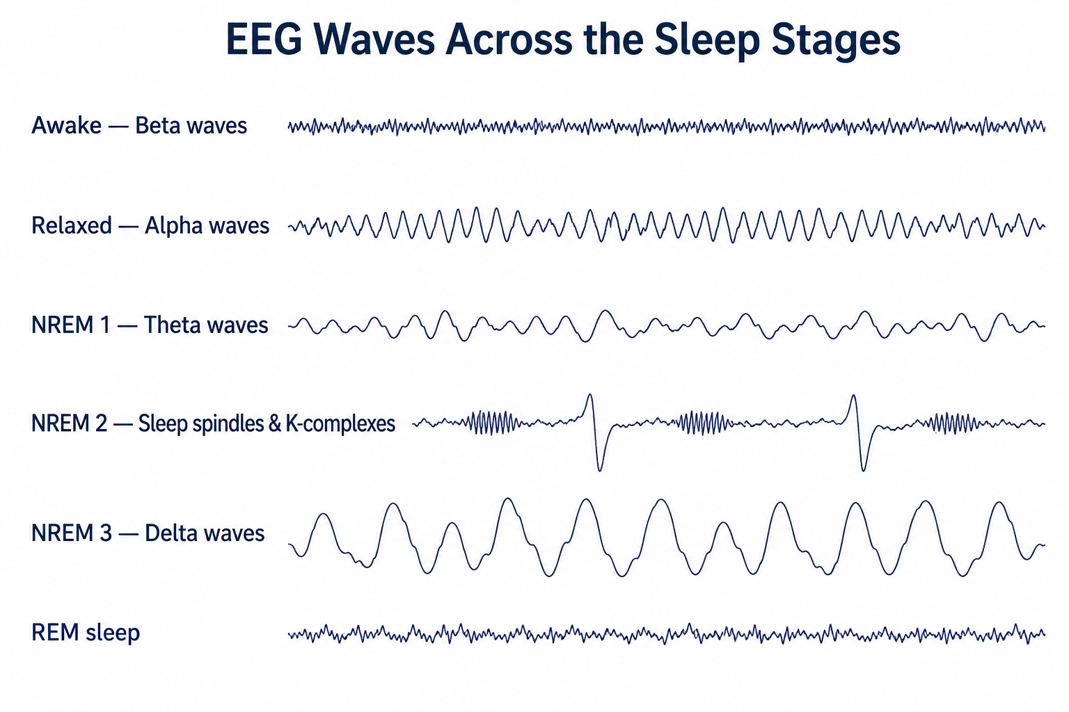 EEG waveform traces across the sleep stages: awake (beta, fast low-amplitude), relaxed (alpha), NREM 1 (theta), NREM 2 (sleep spindles and K-complexes), NREM 3 (delta, slow high-amplitude), and REM (fast low-amplitude).